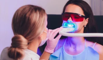 Blanchiment dentaire