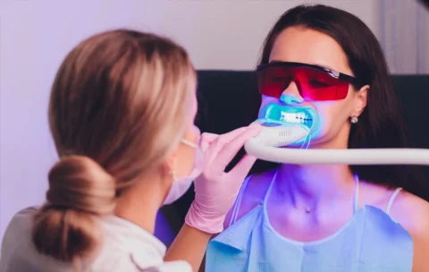 Blanchiment dentaire